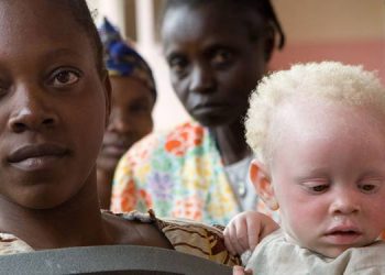 International Albinism Awareness Day 13 June